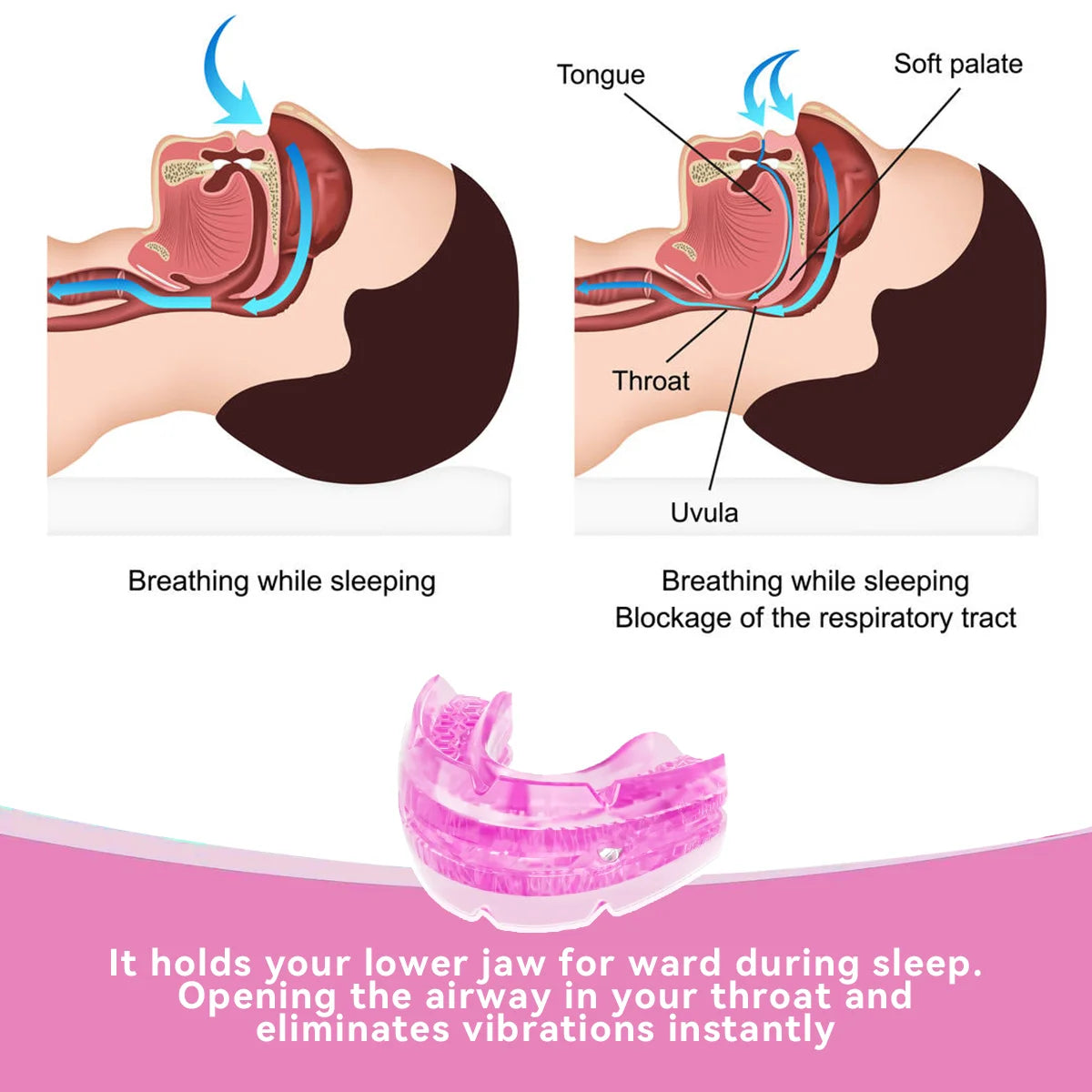 Anti-Snoring Mouth Guard