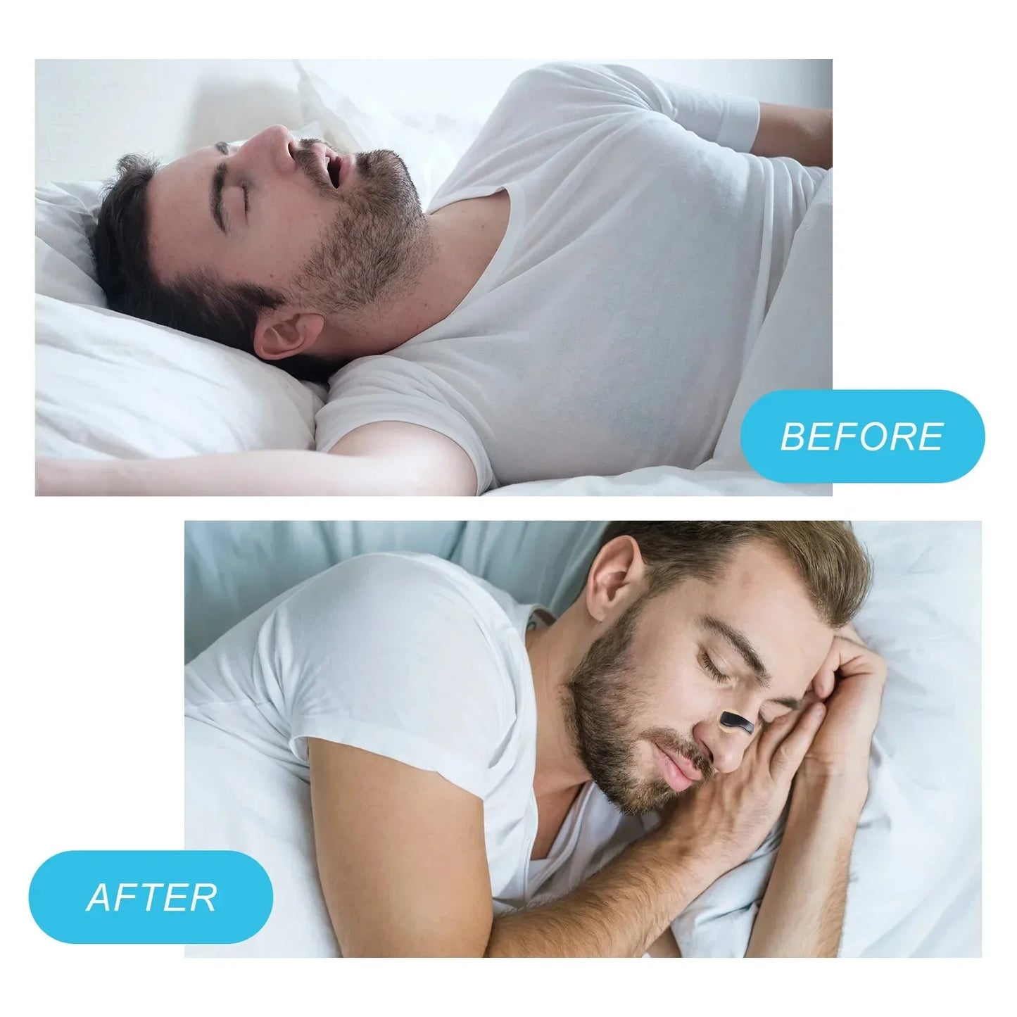 Nasal Breathing Dilators