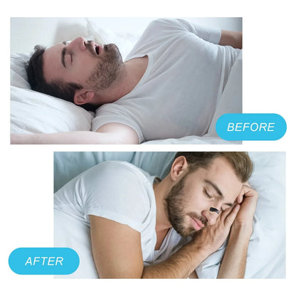 Nasal Breathing Dilators