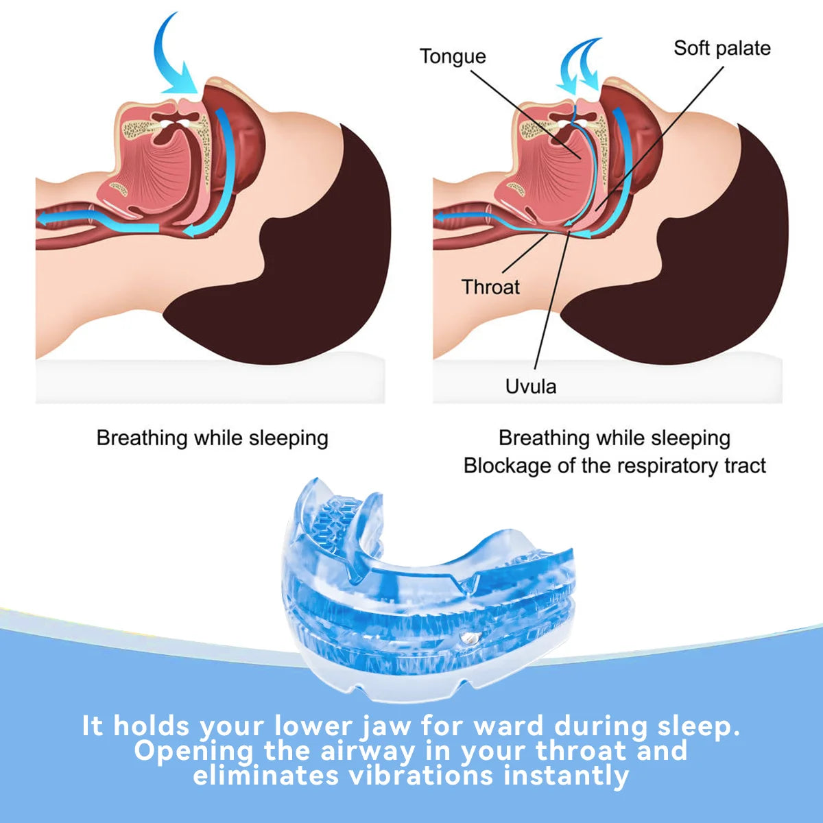 Anti-Snoring Mouth Guard